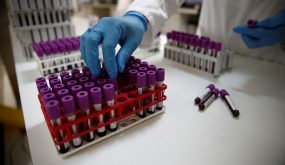 هل ينجح الأردن في التوصل للقاح ضد كورونا