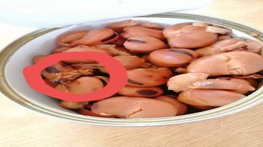 هل تكشف الجهات الرقابية حقيقة العثور على صرصور بعلبة فول