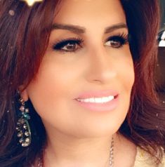 الزميلة العكور لنقابة الأطباء.. خليكم محضر خير..