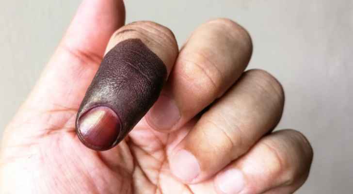 الدبابنة: المرأة تشكل الغالبية العظمى من الناخبين في الأردن بنسبة ٥٢% 